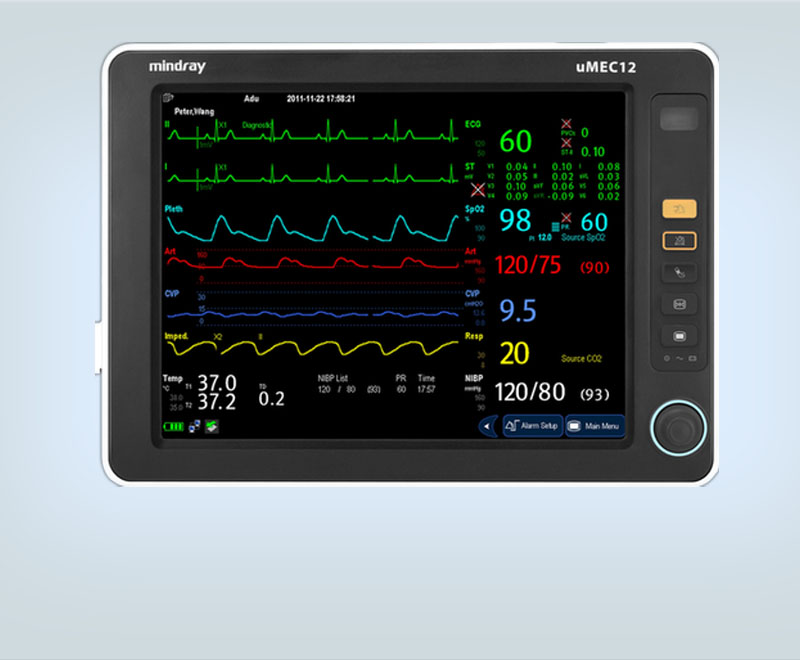 Patient Monitor